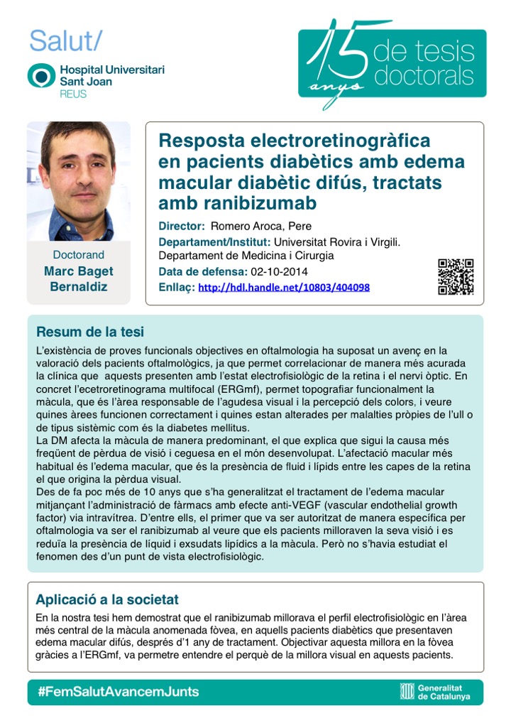 Tesi Marc Baget Bernaldiz